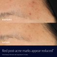 thumbnail image 3 of Estée Lauder Solution de Secours Avancée pour Réparation Nocturne 20 ml, 3 of 5