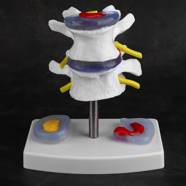 Filfeel Modèle de Colonne Vertébrale Modèle Lombaire Humain Durable PVC, Plus Clairement pour le Bureau à Domicile en Plein Air