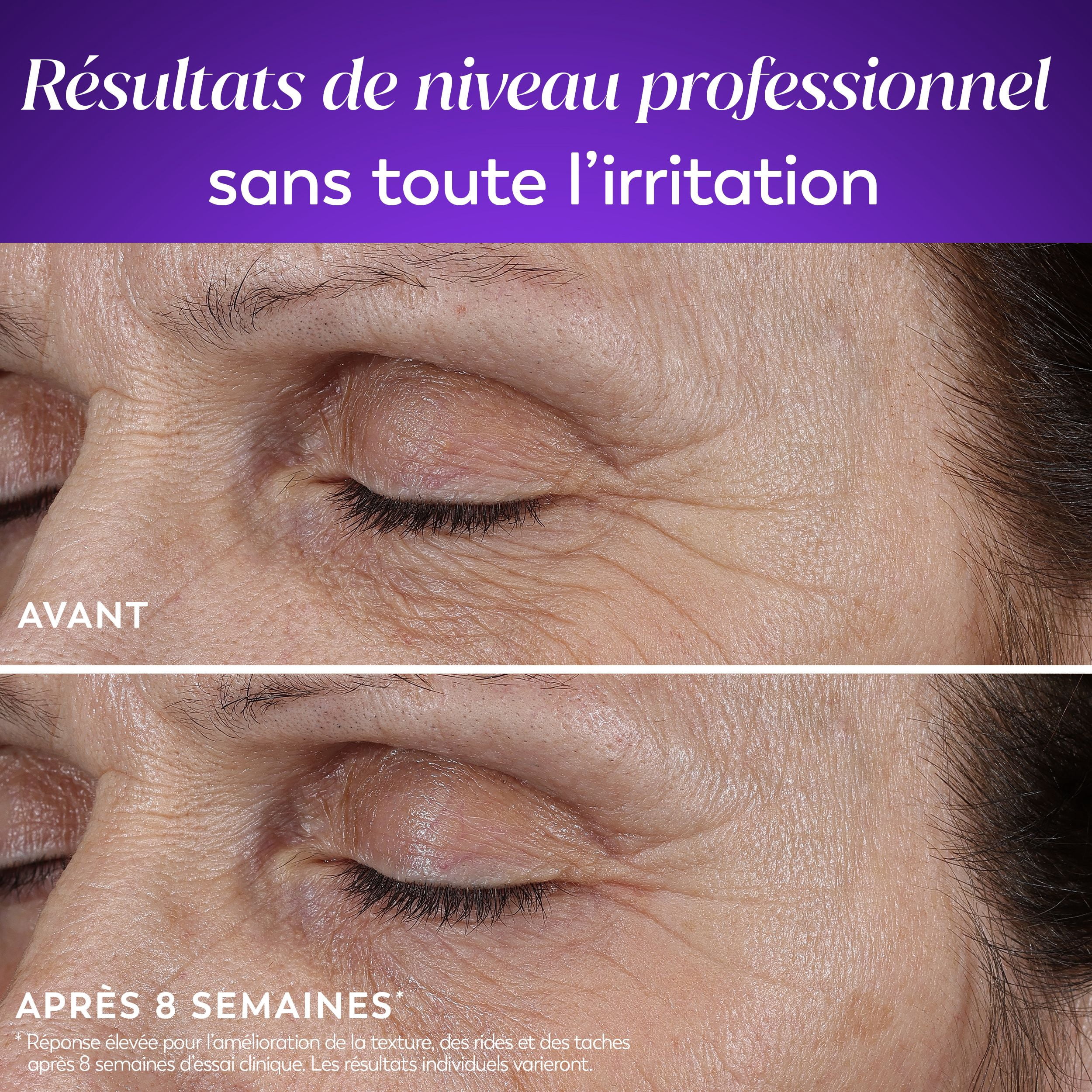 Hydratant Pour Le Visage Olay Rétinol 24 Max, Crème Pour Le Visage, Crème De Nuit Contre Les Rides Anti-Âge, Sans Parfum, 50 mL
