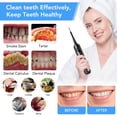 thumbnail image 3 of AFD Electric Plaque Remover for Teeth, Ultrasonic Tooth Cleaner Dental Calculus Remover with LED Display Teeth Cleaning Kit Safe for Both Adult Kids (Black-A), 3 of 8