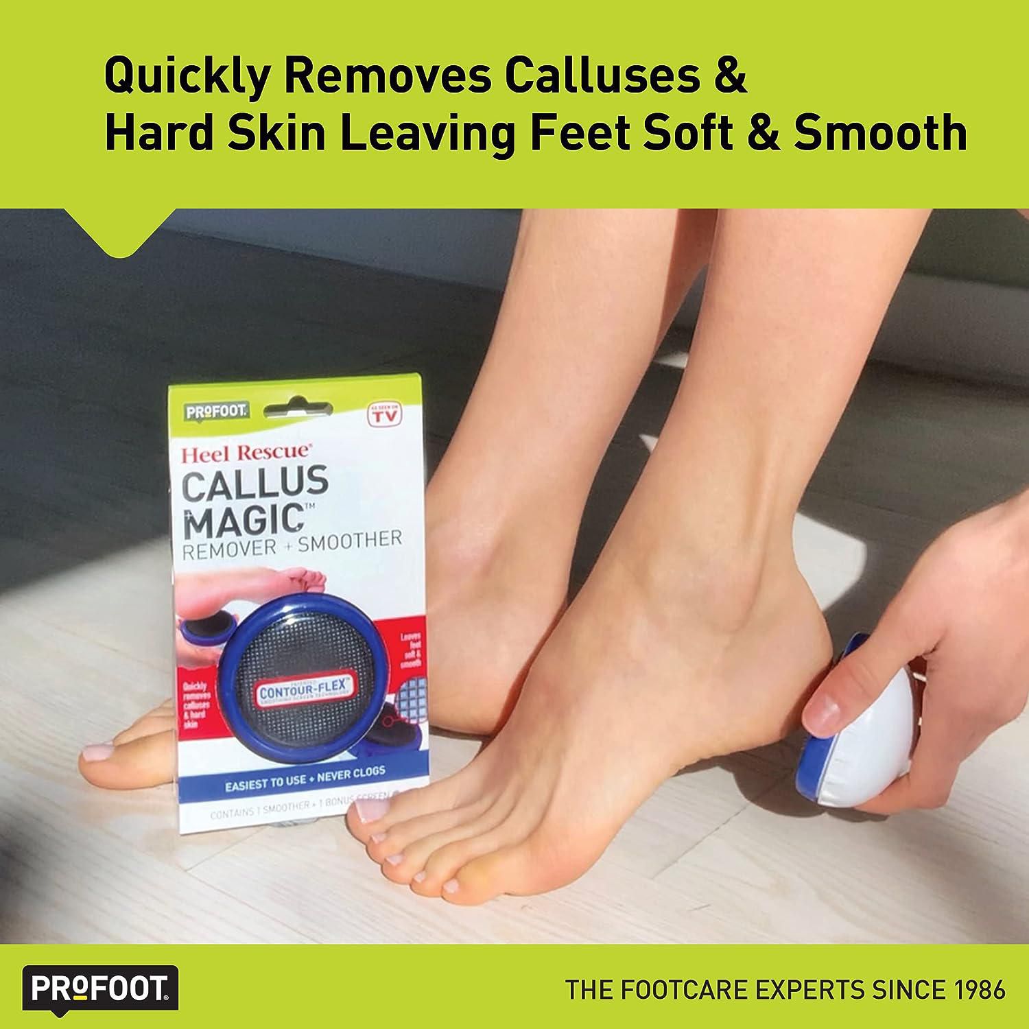 Hard callus hot sale on heel