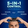 thumbnail image 4 of Selsun Blue ACTIV Hydration Anti-Dandruff Shampoo, 300mL, Controls Dandruff and Flaking, Moisturizes Scalp, 4 of 9