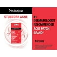 thumbnail image 2 of Neutrogena Stubborn Acne Blemish Patches, Hydrocolloid Spot Treatment, Pimple Care Patch, Hypoallergenic, 2 of 5