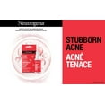 thumbnail image 4 of Neutrogena Stubborn Acne Blemish Patches, Hydrocolloid Spot Treatment, Pimple Care Patch, Hypoallergenic, 4 of 5