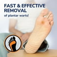 thumbnail image 3 of Dr. Scholl's Plantar Wart Remover Gel, 16 Count Cover-up Discs, 3 of 8