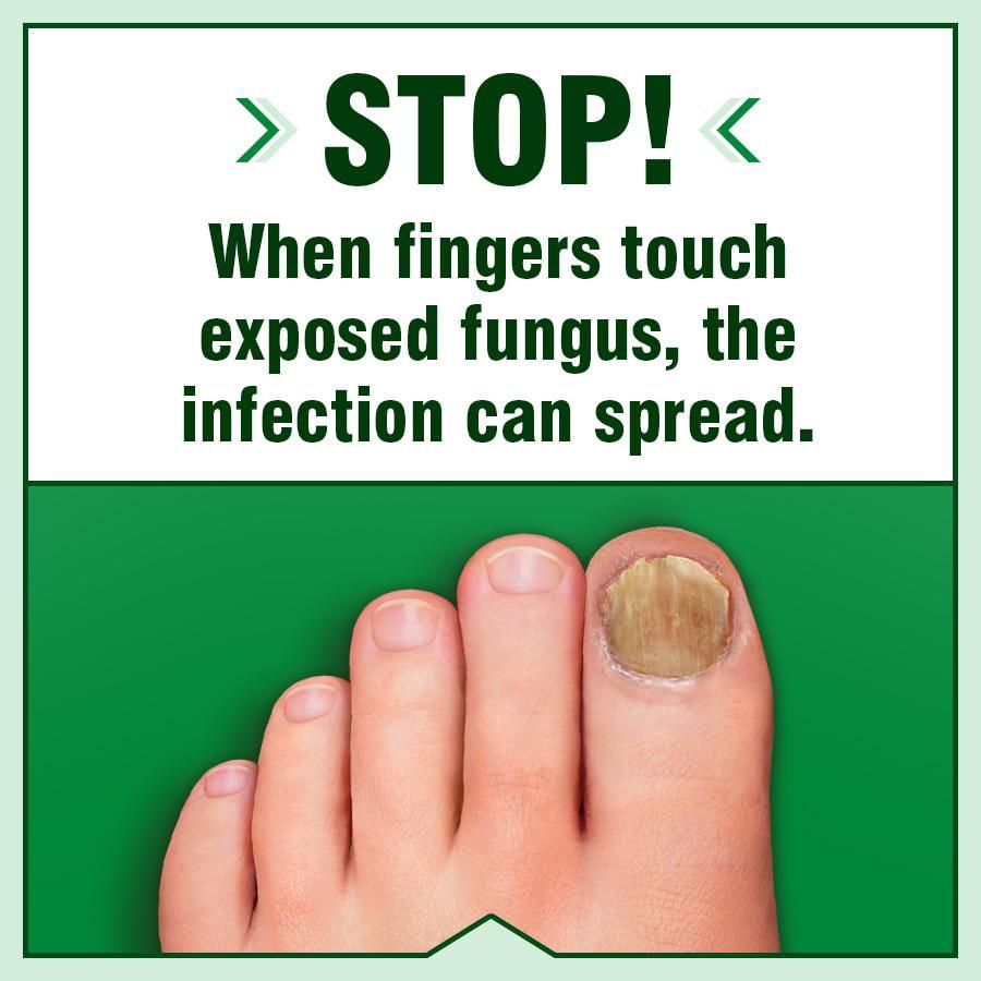 Fungicure Anti-Fungal Liquid Topical Formula Maximum Strength, 30 mL