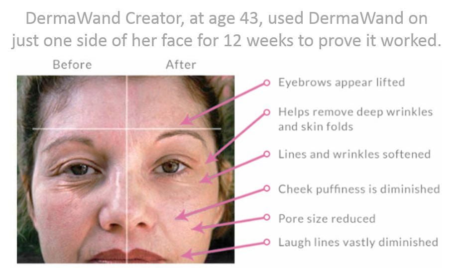 dermawand skin care