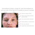 thumbnail image 4 of Système de soins anti-âge DermaWand, 4 of 5