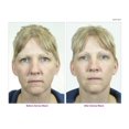 thumbnail image 5 of Système de soins anti-âge DermaWand, 5 of 5