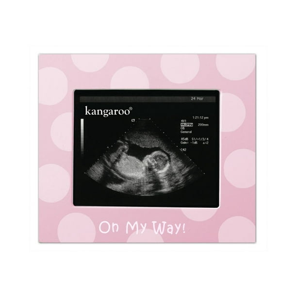 Cadre photo de sonogramme de bébé de Kangaroo - rose