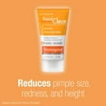 thumbnail image 2 of Neutrogena Rapid Clear Spot Gel, Acne Treatment with Witch Hazel and Salicylic Acid, for Acne-Prone Skin, 2 of 7