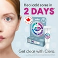 thumbnail image 3 of CLERA Cold Sore Treatment. Heals your cold sore in 2 days. Clinically proven. 5 ml, 3 of 5