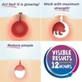 thumbnail image 5 of Clearasil® Ultra® Cleansing Cream Wash, Acne Treatment, 5 of 5