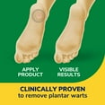 thumbnail image 3 of Dr. Scholl’s® le traitement Clear Away®, 24 unité traitements, 3 of 6