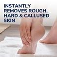 thumbnail image 2 of Dr. Scholl’s® Callus Filer, One Size, Instantly Removes Rough, Hard and Callused Skin, 2 of 7