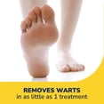 thumbnail image 3 of Dr. Scholl's Traitement Des Verrues Freeze Away®, 12 traitment, 3 of 9