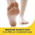 thumbnail image 3 of Dr. Scholl's Freeze Away Wart Remover Common & Plantar, 12 Count Treatments, 3 of 6