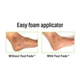 thumbnail image 2 of Pro-Cure Fast Fade Arnica Gel, 2 of 2