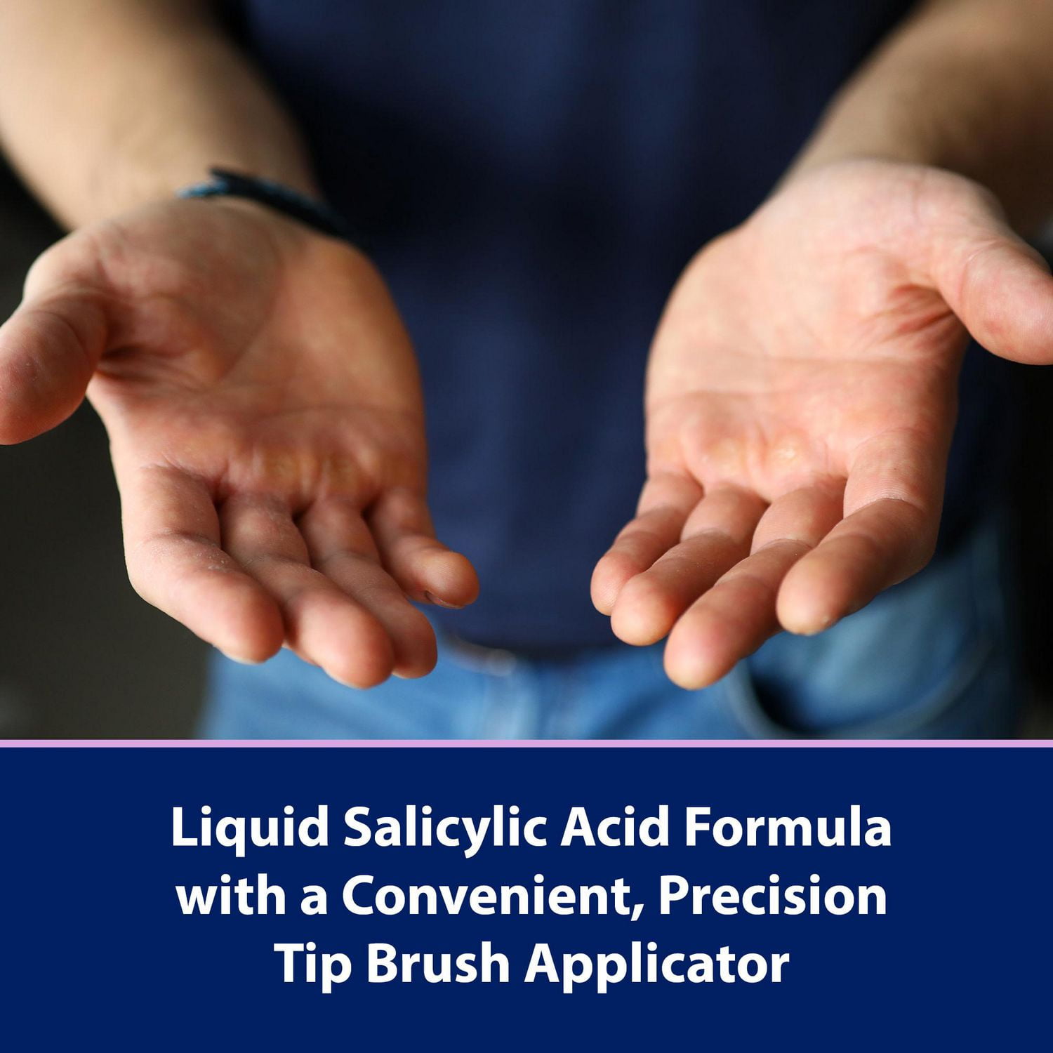 Compound W Fast Acting Liquid, 10 ML Liquid