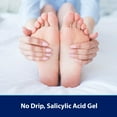 thumbnail image 3 of Compound W Maximum Strength Fast Acting Gel, 3 of 7