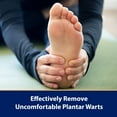 thumbnail image 4 of Compound W Maximum Strength One Step Plantar Foot Pads, 4 of 7