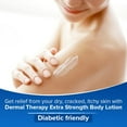 thumbnail image 4 of Dermal Therapy™ Extra Strength Body Lotion, 4 of 5
