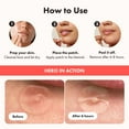 thumbnail image 4 of Hero Cosmetics Mighty Patch Original, Hydrocolloid Patch for Pimples, Overnight Acne Blemish & Zit Stickers for Sensitive Skin, 24 Count, 4 of 5