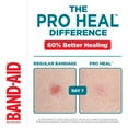 thumbnail image 3 of Band-Aid Pro Heal Adhesive Bandages, Regular Size, First Aid, Wound Care Dressing, Waterproof Healing Bandage, 3 of 6
