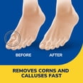 thumbnail image 2 of Dr. Scholl's Liquid Corn & Callus Remover Salicylic Acid, 3 Cushions, 9.8ml, 2 of 6