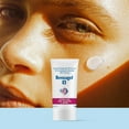 thumbnail image 5 of BENZAGEL ACNE GEL, 5 of 5