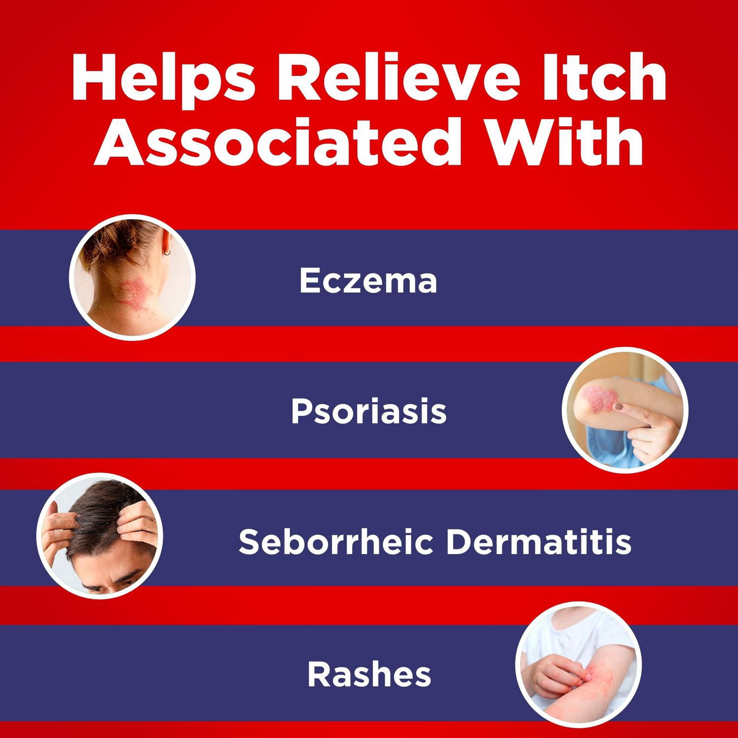 Cortizone-10 Crème pour soulager l'eczéma, concentration maximale 1% hydrocortisone, effet rapide, soulage les démangeaisons liées aux irritations cutanées mineures, l’inflammation et les éruptions cutanées dues à l’eczéma, 28 g