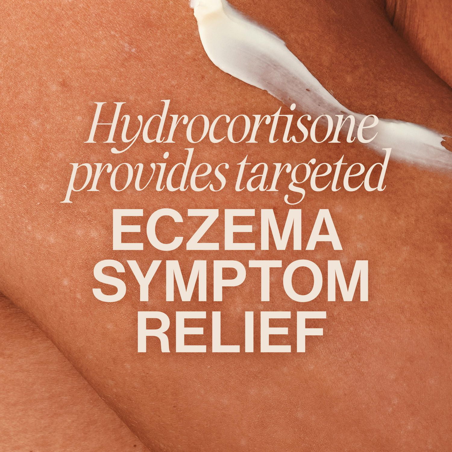 Gold Bond Eczema Relief Crème Médicamentée 1% Hydrocortisone, 56g, traitement médicamenteux de l'eczéma avec 5 hydratants pour soulager les démangeaisons, les éruptions cutanées, les rougeurs, la rugosité, les irritations et l'inflammation 56 g