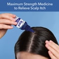 thumbnail image 2 of Nizoral Scalp Itch Relief Liquid, 2 of 7