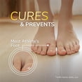thumbnail image 3 of Dr. Scholl’s Athlete's Foot Antifungal Cream Treatment, Itching & Burning Relief, Treats Athlete’s Foot, 3 of 9