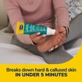 thumbnail image 3 of Dr. Scholl's Fast Acting Callus Remover Gel Kit, 3 of 7