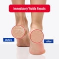 thumbnail image 4 of Crème hydratante intense pour les pieds Heal & Rescue, 4 of 9