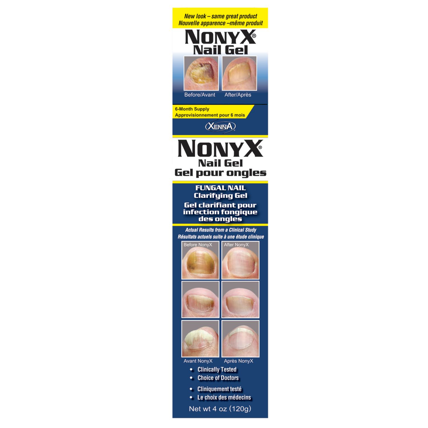 Xenna Nonyx Nail Gel front-facing tube and applicator on white background. Nail treatment clear gel that breaks down and clears dark or yellowing keratin debris and reduces or eliminates nail lifting. Improves nail appearance, colour and clarity; patented ethanoic acid exfoliant; used by podiatrists; paraben free; safe for diabetics with healthy feet.
