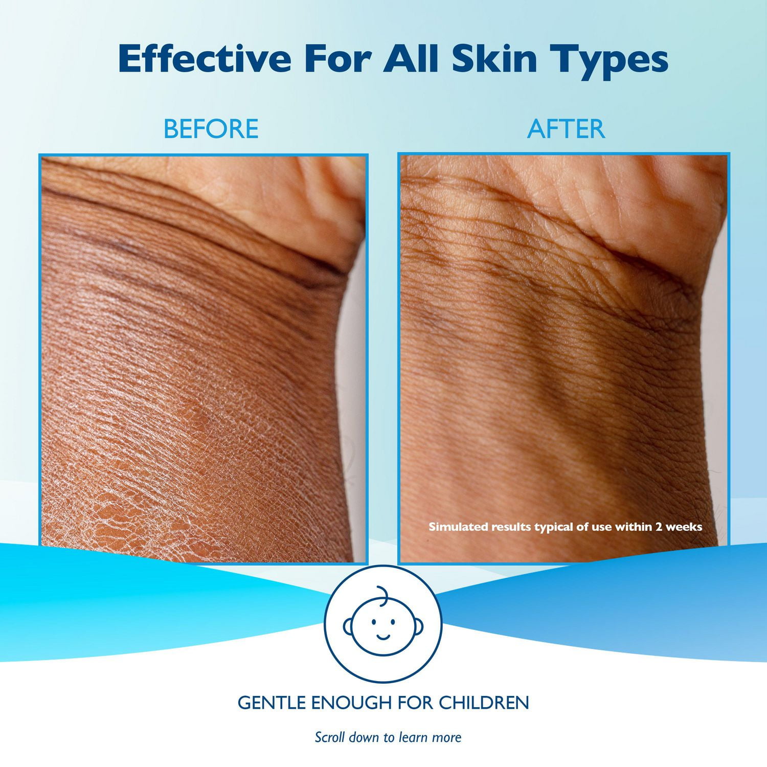 Glaxal Base Sensitive Skin Moisturizing Cream, 100 g