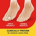 thumbnail image 3 of Dr. Scholl’s® Corn Removers with Duragel™ Technology, 6 Medicated Discs, 3 of 6