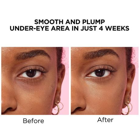 under eye concealer with hyaluronic acid