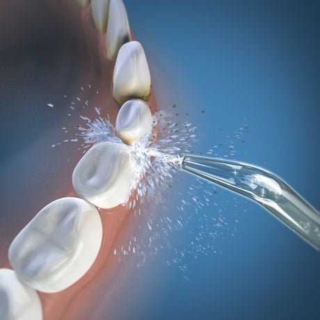 waterpik whitening water pik tablets refill flosser wt inc jet classic professional wjt 2e canada tips oral health tip